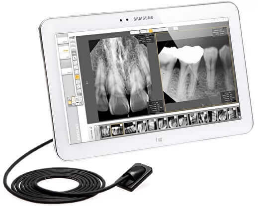 Прицельный снимок (рентген зуба) и визография (цифровой снимок зуба)