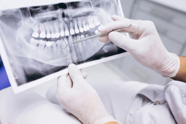 Етапи відновлення повної чи часткової втрати зубів