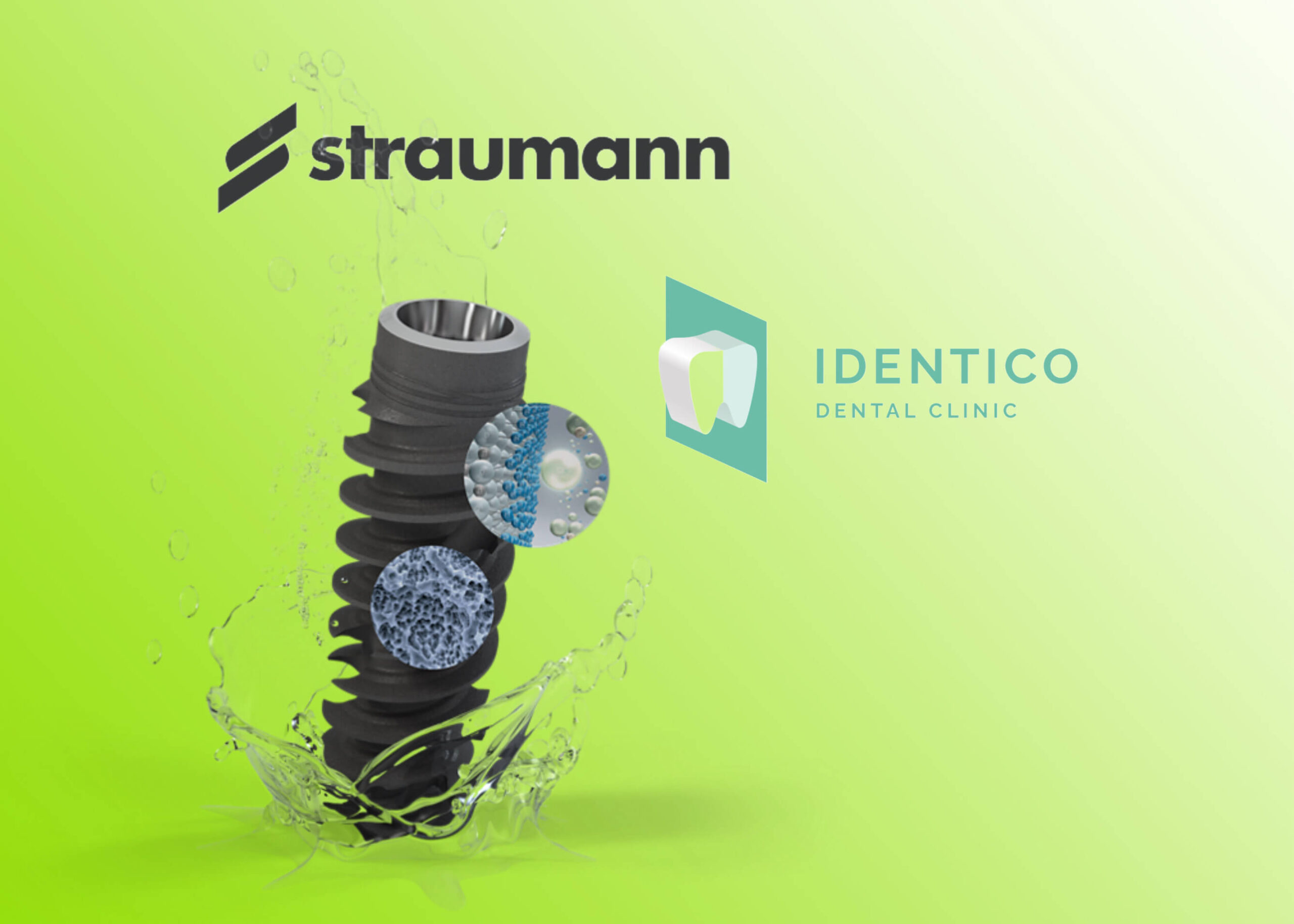 Імпланти Штрауман (Straumann)