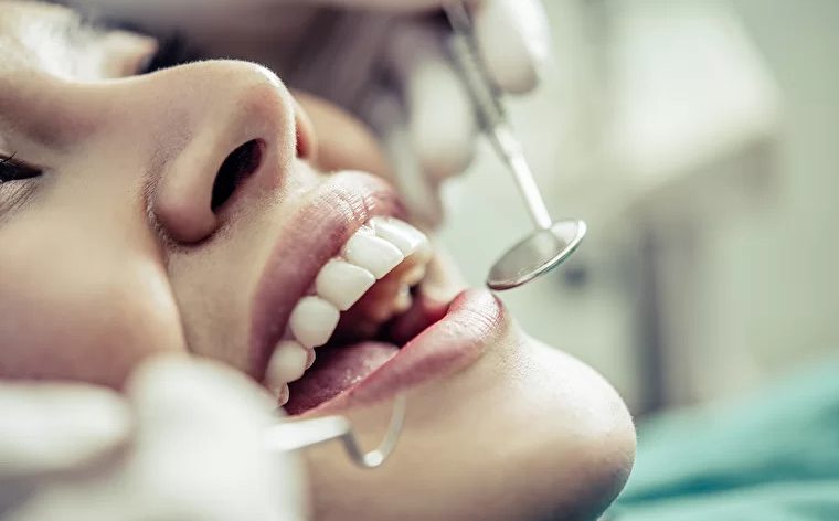 Кіста зуба: лікування, причини виникнення